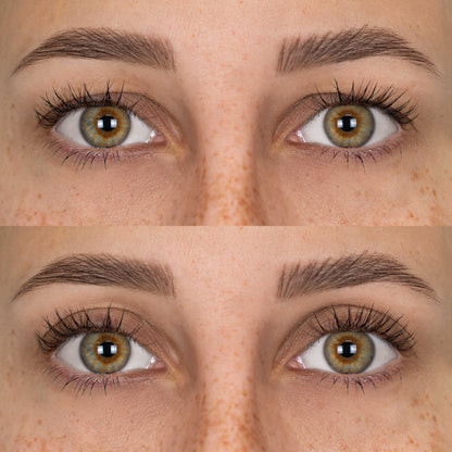 Patchs Lift Paupières